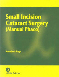 SMALL INCISION CATARACT SURGEY