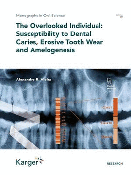 THE OVERLOOKED INDIVIDUAL: SUSCEPTIBILITY TO DENTAL CARIES, EROSIVE TOOTH WEAR AND AMELOGENESIS