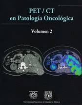 PET / CT EN PATOLOGIA ONCOLOGICA VOL. I. BEZAURY RIVAS PAULINA. Libro ...