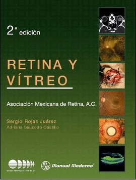 RETINA Y VITREO 2 EDIC.