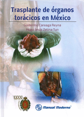 TRANSPLANTES DE ORGANOS TORACICOS EN MEXICO