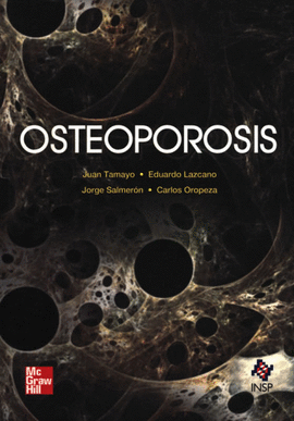 OSTEOPOROSIS