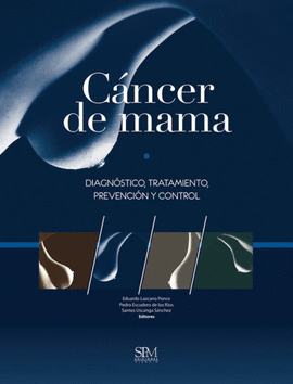 CÁNCER DE MAMA. DIAGNÓSTICO, TRATAMIENTO, PREVENCIÓN Y CONTROL