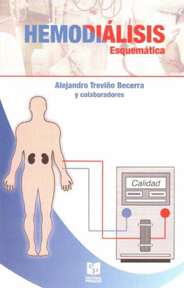 HEMODIALISIS ESQUEMATICA