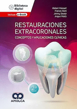 RESTAURACIONES EXTRACORONALES. CONCEPTOS Y APLICACIONES CLINICAS