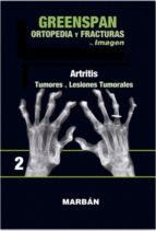 ORTOPEDIA Y FRACTURAS TOMO II: PREMIUM: ARTRITIS: TUMORES, LESIONES TUMORALES