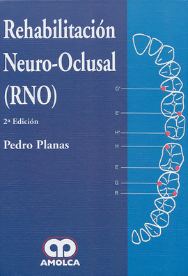 REHABILITACION NEURO-OCLUSAL(RNO)