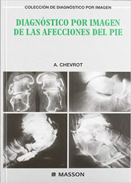 DIAGNOSTICO POR IMAGEN DE LAS AFECCIONES DEL PIE