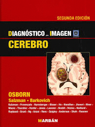 DIAGNOSTICO POR IMAGEN CEREBRO AMIRSYS ROJO