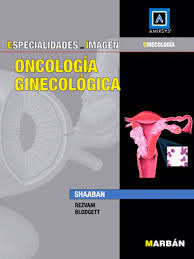 ONCOLOGIA GINECOLOGICA