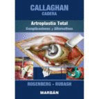 CALLAGHAN: CADERA: ARTROPLASTIA TOTAL: COMPLICACIONES Y ALTERNATIVAS