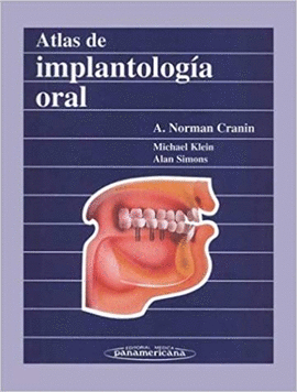 ATLAS DE IMPLANTOLOGIA ORAL