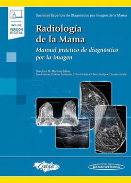 RADIOLOGÍA DE LA MAMA