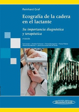 ECOGRAFIA DE LA CADERA EN EL LACTANTE