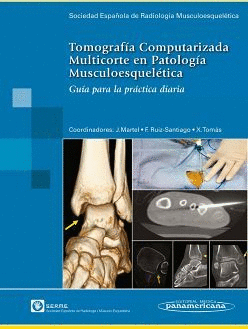 TOMOGRAFIA COMPUTARIZADA MULTICORTE EN PATOLOGIA MUSCULOESQUELETICA. GUIA PARA LA PRACTICA DIARIA