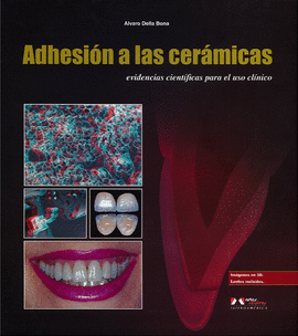 ADHESION A LAS CERAMICAS, EVIDENCIAS CIENTIFICAS PARA EL USO CLINICO