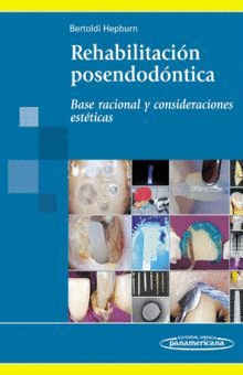 REHABILITACION POSENDODONTICA. BASE RACIONAL Y CONSIDERACIONES ESTETICAS