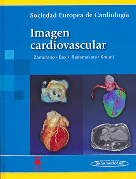 IMAGEN CARDIOVASCULAR