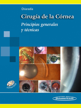 CIRUGIA DE LA CORNEA