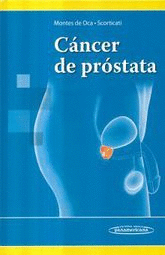 CANCER DE PROSTATA