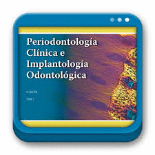 PERIODONTOLOGIA CLINICA E IMPLANTOLOGIA ODONTOLOGICA