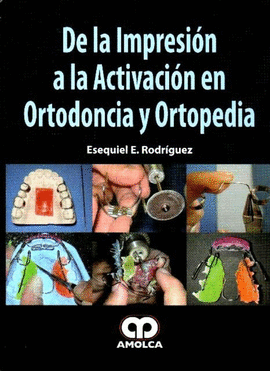 DE LA IMPRESIÓN A LA ACTIVACIÓN EN ORTODONCIA Y ORTOPEDIA