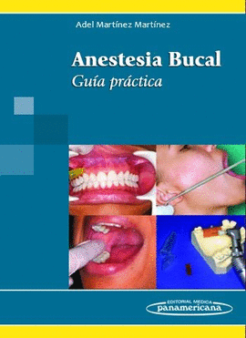 ANESTESIA BUCAL GUIA PRACTICA