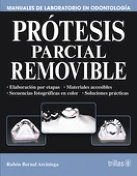 PROTESIS PARCIAL REMOVIBLE
