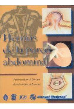 HERNIAS DE LA PARED ABDOMINAL