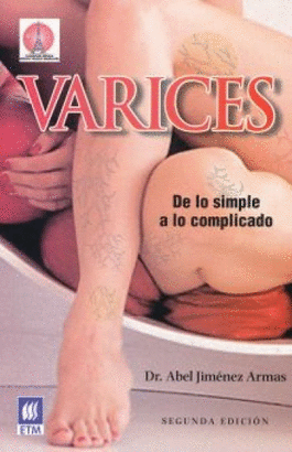 VARICES DE LO SIEMPLE A LO COMPLICADO