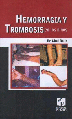 HEMORRAGIA Y TROMBOSIS EN LOS NIÑOS