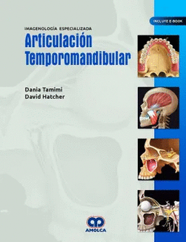 ARTICULACION TEMPOROMANDIBULAR. IMAGENOLOGIA ESPECIALIZADA