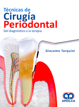 TÉCNICAS DE CIRUGÍA PERIODONTAL DEL DIAGNÓSTICO A LA TERAPIA