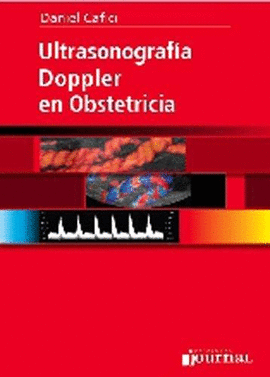 ULTRASONOGRAFIA DOPPLER EN OBSTETRICIA 1° EDICION