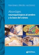 ABORDAJES NEUROQUIRURGICOS AL CEREBRO Y A LA BASE DEL CRANEO