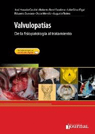 VALVULOPATIAS DE LA FISIOPATOLOGIA AL TRATAMIENTO
